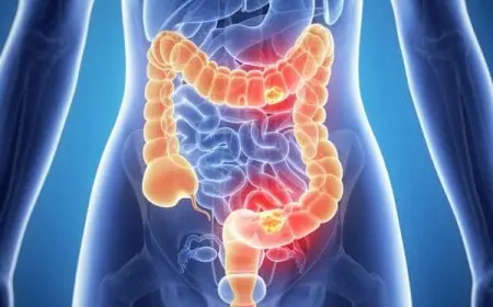 كيف اعرف خروج السموم من الجسم