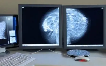 هل أشعة الماموجرام مؤلمة