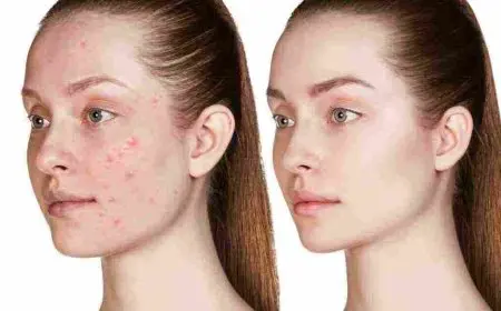 نصائح لحماية الوجه من ظهور البقع السوداء