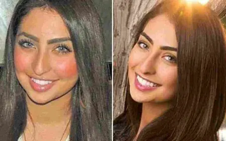 نور الغندور قبل وبعد