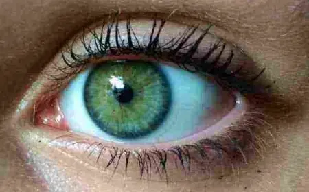 تفسير حلم رؤية العين البيضاء في المنام