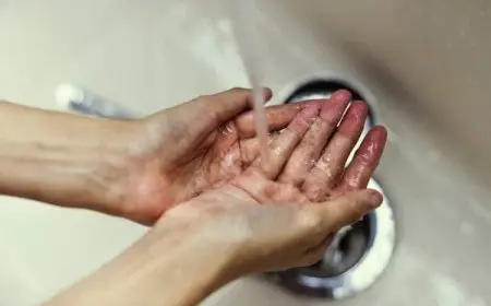 طريقة إزالة الفوم اللاصق من اليد