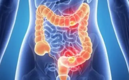 كيف تعرف الحمام الذكر من الانثى