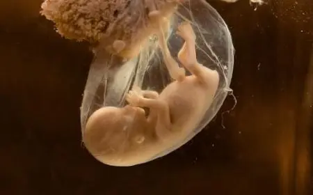 متى يكون نقص ماء الجنين خطر