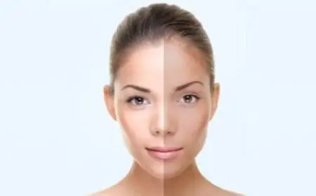 تفتيح البشرة الدهنية في أسبوع