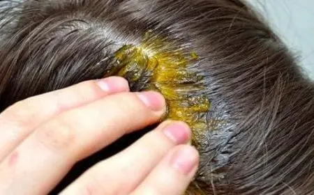 متى تظهر نتائج زيت الثوم للشعر