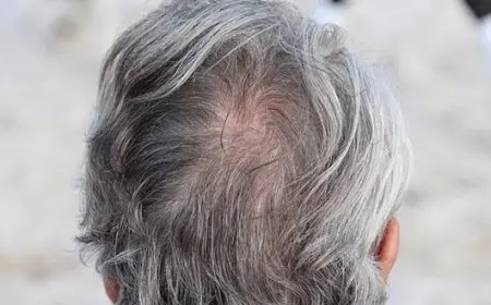 أفضل صبغة للشيب جابر القحطاني