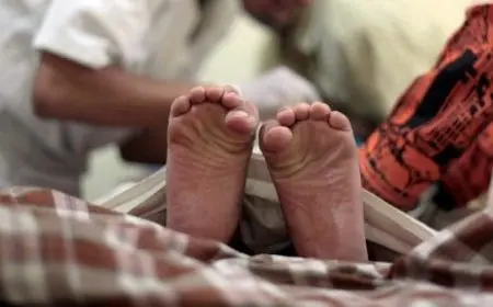 ما معنى الختان للذكور؟