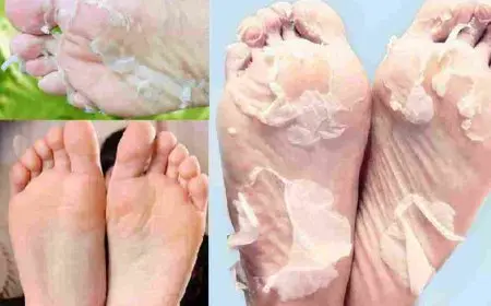 ازالة الجلد الميت من القدمين بالخل