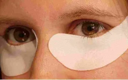 علاج انتفاخ تحت العين طبيا