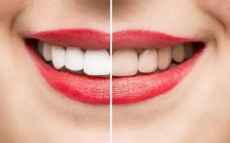 أفضل معجون لتبييض الأسنان