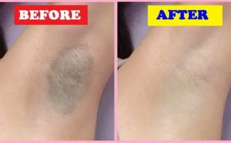 التخلص من سواد الإبط في أسبوع