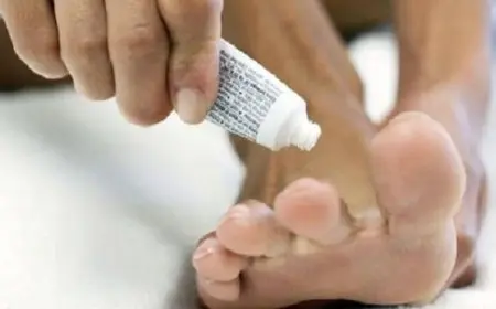 أفضل كريم لعلاج فطريات أصابع القدم