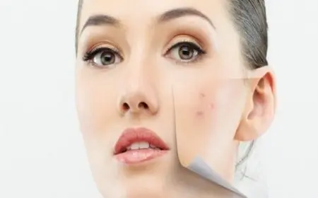 إزالة البقع من الوجه في يومين