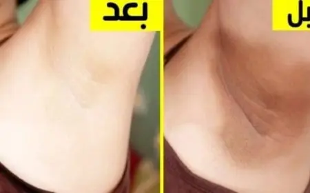 أفضل 7 كريمات لتفتيح المناطق الحساسة من الصيدلية فعالة ومجربة