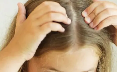 أسباب تساقط الشعر عند الأطفال وطرق علاجه