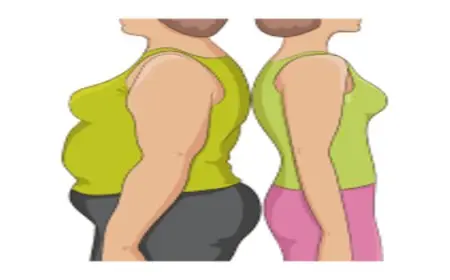 تجربتي مع شد الزنود بالليزر