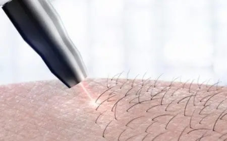 كم جلسة ليزر تحتاج منطقة البكيني؟