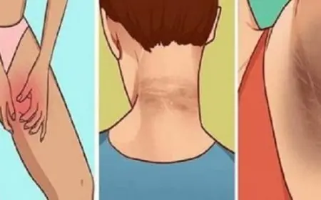 علاج سواد المناطق الحساسة طبيا