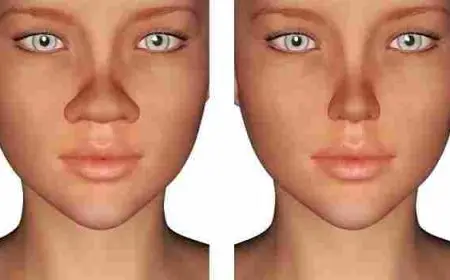 تمارين لتصغير الأنف العريض