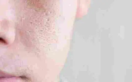 تصغير مسامات الوجه تجربتي