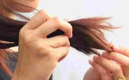 علاج تقصف الشعر الشديد تجربتي