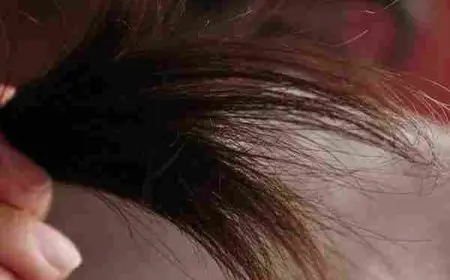 علاج تقصف الشعر من الصيدلية للاطفال