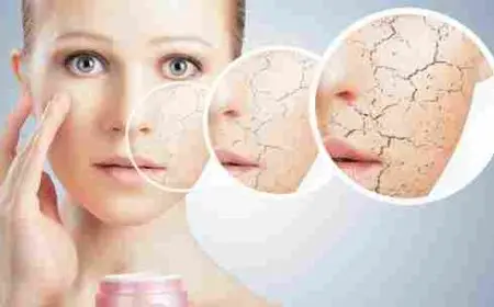 كريمات ترطيب البشرة الجافة