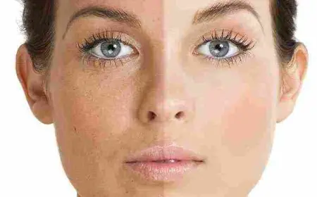 ماسك لتوحيد لون البشرة وإزالة البقع