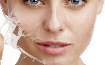 التقشير الكيميائي في المنزل