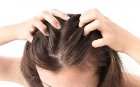 ظهور بقع حمراء على فروة الرأس الأسباب والعلاج