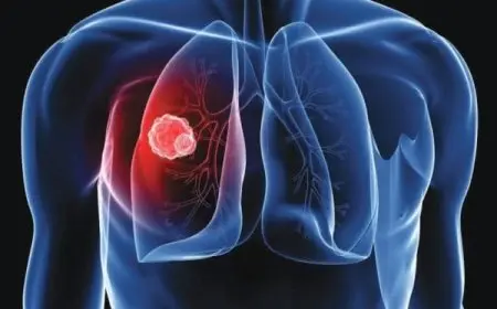 تجربتي مع جلطة الرئة