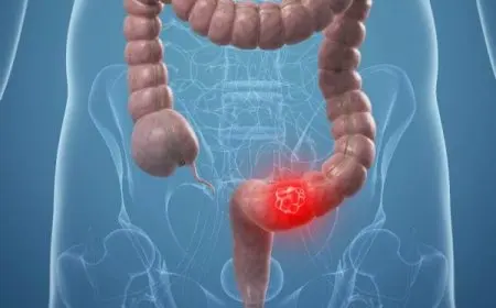 تجربتي مع حبوب تنظيف القولون