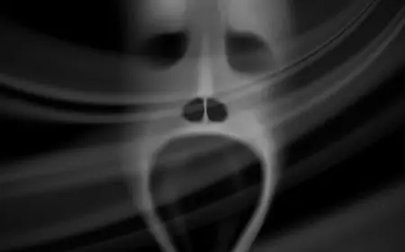 علامات موت العارض في الجسم