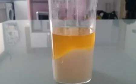 فحص الحمل بالملح بالصور