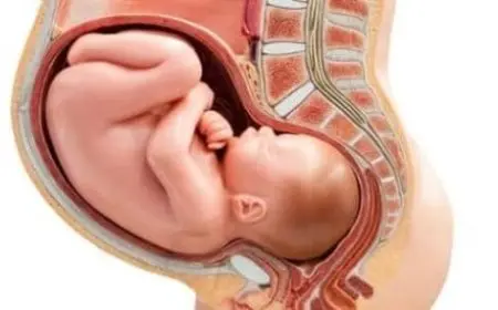 شكل البطن عند نزول رأس الجنين في الحوض