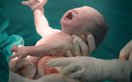 البنج النصفي أفضل أم الكلي في الولادة القيصرية