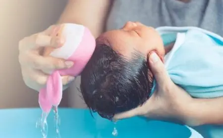 كيف أزيل قشرة رأس الرضيع