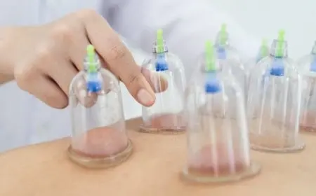 علاج المثانة العصبية بالحجامة