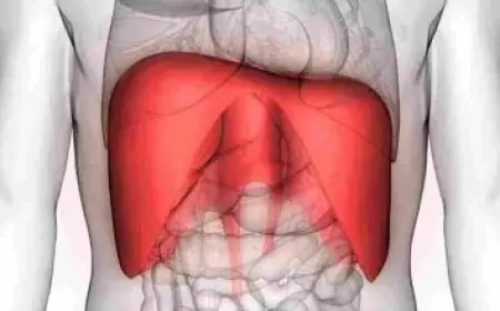 مصاريف جامعة MTI