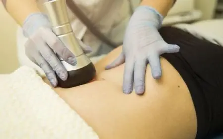 تجربتي مع نحت الجسم بالليزر