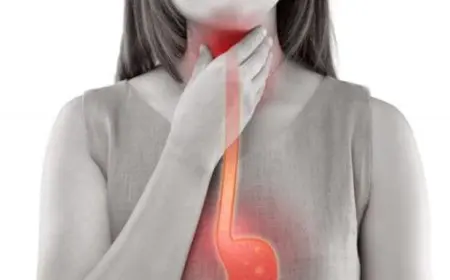 تجربتي مع ارتجاع المريء