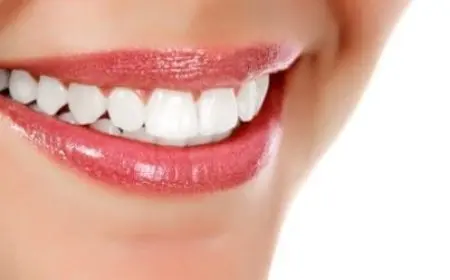 عروض ابتسامة هوليود الجديدة 2024