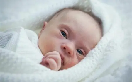 شكل أطفال متلازمة داون حديثي الولادة