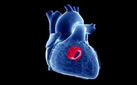 تجربتي مع ارتخاء الصمام الميترالي