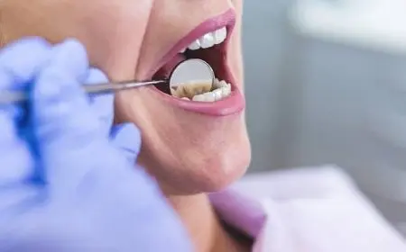 هل يسقط السن بعد سحب العصب