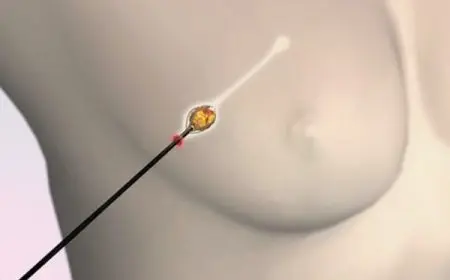 تجربتي مع فأرة الثدي