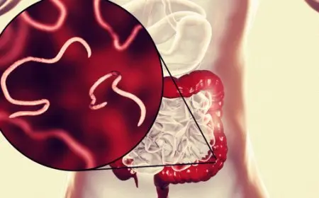 تجربتي مع الديدان الدبوسية