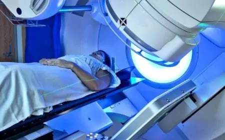 هل يعود السرطان بعد العلاج الإشعاعي