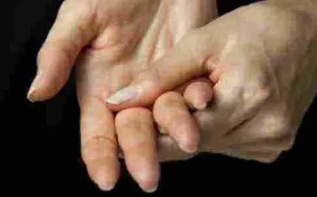 أعراض الروماتيزم في اليدين